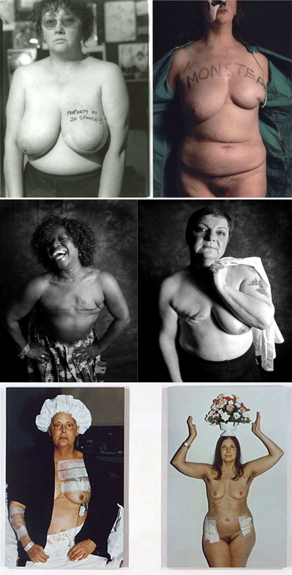 Fig. 17 De arriba abajo: a. Jo Spence, The Picture of Health (1982-1986); b. Jo Spence, Narratives of Disease (1990); c. Ami Barwell, Mastectomy (2017). Gillian (izquierda) y Mel (derecha), dos de las retratadas en la serie; d. Hannah Wilke, Intra-Venus (1991-1992).